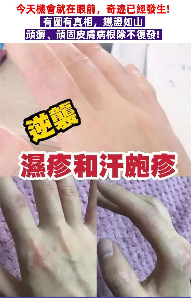 苗疆百草膏QUMAO1781067445503683.jpg 苗疆百草膏,這個藥膏絕對是買了不踩雷的,止癢超好而且不刺激很溫和,塗上舒舒服服的,到的當天我就用上了,之前晚上這腿上的蘚是癢的睡不着,現在已經徹底不癢了。也才用了一個來禮拜的樣子現在已經好了,晚上再也不會癢的睡不着了!